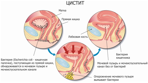 Глево (Glevo) таблетки. Инструкция по применению, цена, отзывы