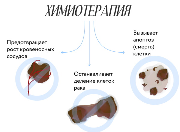 Рак гортани. Симптомы, фото, лечение