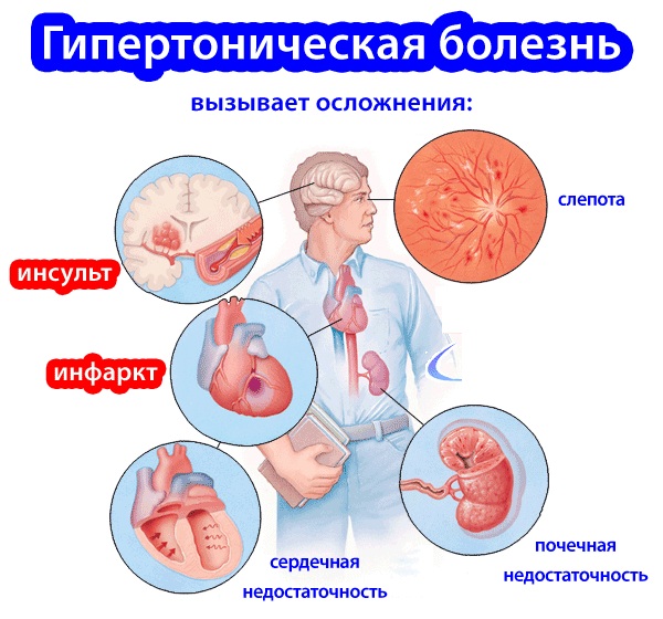Чага. Лечебные свойства березового гриба, рецепты, способы применения. Противопоказания