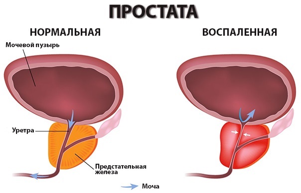 Подвздошная область. Где находится у человека правая/левая, как болит, причины