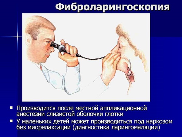 Рак гортани. Симптомы, фото, лечение