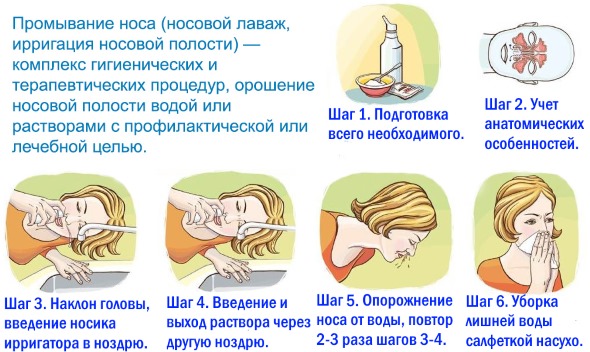 Протаргол (Protargol). Инструкция по применению взрослым для носа, цена