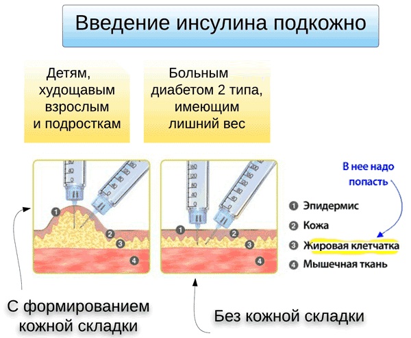 Сахарный диабет 2 типа. Диета и лечение, клинические рекомендации