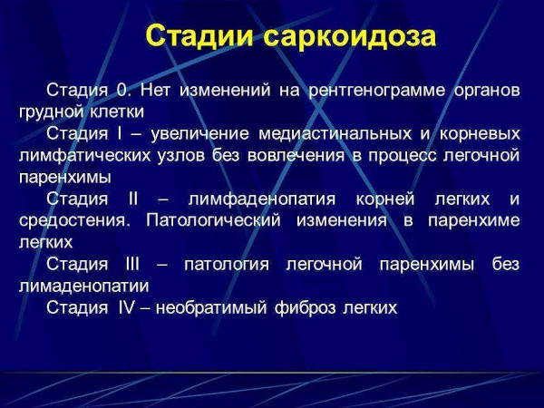 Саркоидоз легких. Что это за болезнь, прогноз