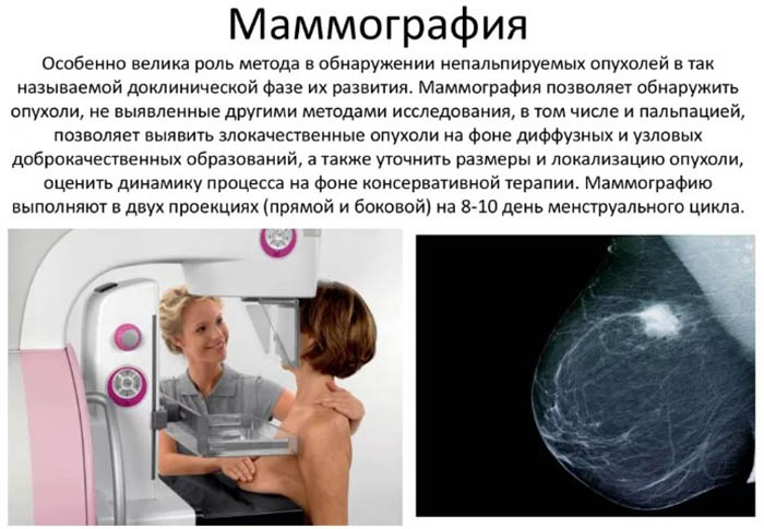 Секторальная резекция молочной железы. Что это такое, восстановление