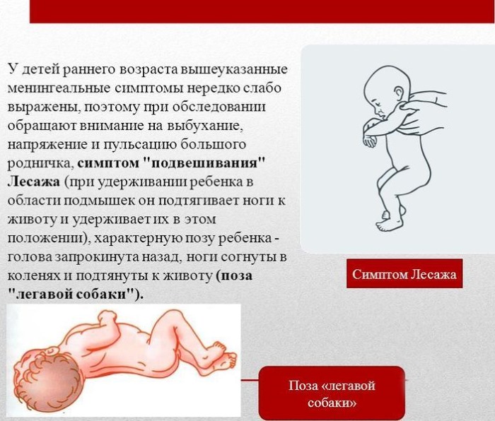Менингит у детей 5-10 лет. Симптомы, как проявляется