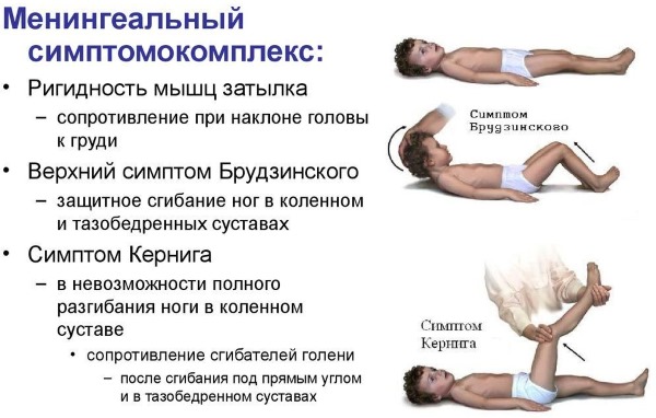 Менингит у детей 5-10 лет. Симптомы, как проявляется
