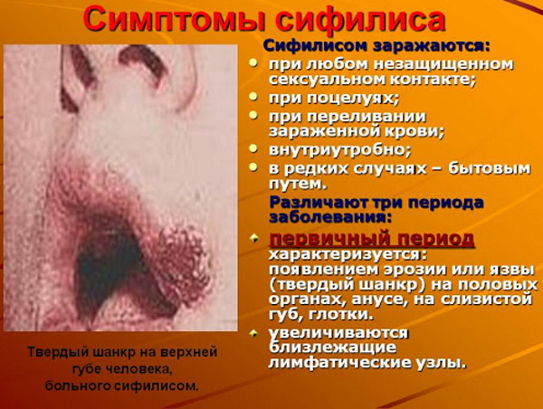 Сифилис на губах. Фото, как выглядит, как проявляется