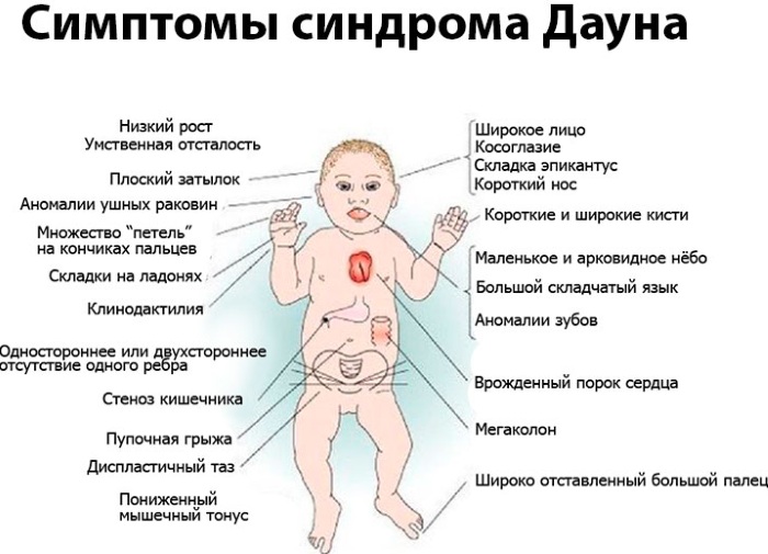 Трисомия 21.18.13: норма в 1 триместре у беременных