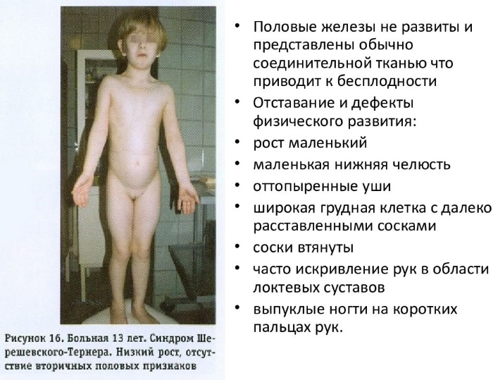 Сколько хромосом у человека в норме. Количество, классификация, патологии