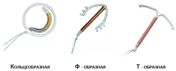 Спираль от беременности. Фото, виды, стоимость, как работает, как ставят