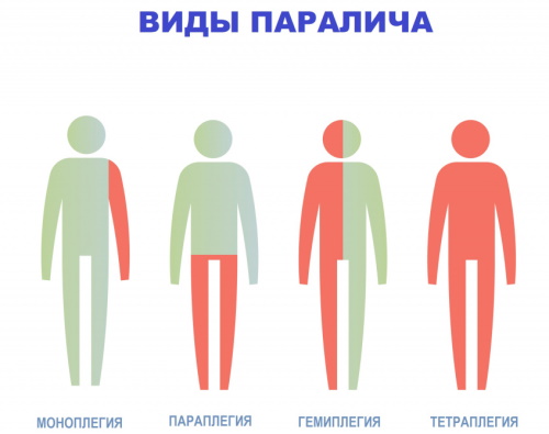 Нарушение статики шейного отдела позвоночника, поясничного, пояснично-крестцового, грудного