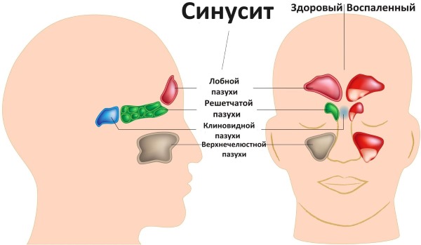 Глево (Glevo) таблетки. Инструкция по применению, цена, отзывы