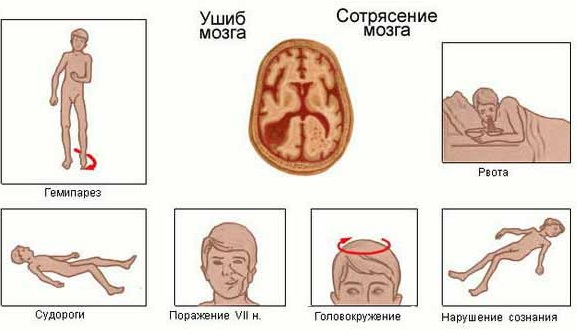 Стреляет за ухом в голове слева, справа. Что это такое, причины, лечение