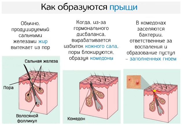 Гидролипидная мантия кожи. Что это такое, ph, функция, состав, нуф виды и типы увлажнения головы, рук, тела