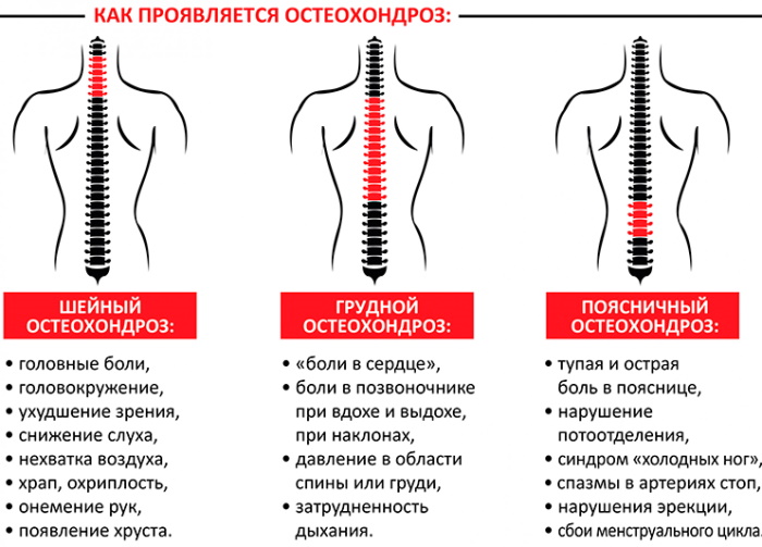 Хрустнула шея и больно поворачивать голову. Что делать