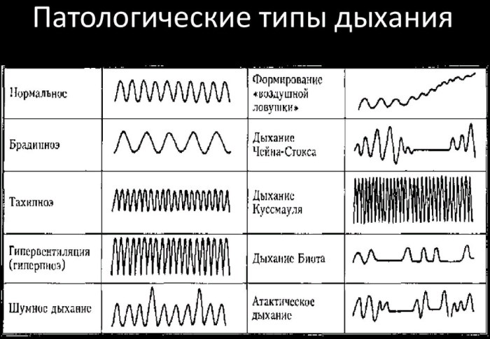 Типы дыхания у женщин, мужчин в норме: грудное, брюшное