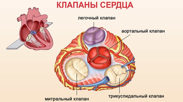 Пороки сердца врожденные и приобретенные. Виды, классификация