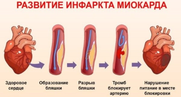 Температура при цистите у женщин. Может ли быть, сколько держится