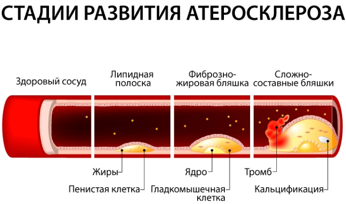 Кровеносные сосуды человека. Схема системы кровообращения, анатомия