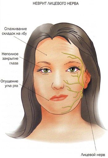 Арсеникум альбум (Arsenicum album) гомеопатия. Показания к применению, инструкция, цена