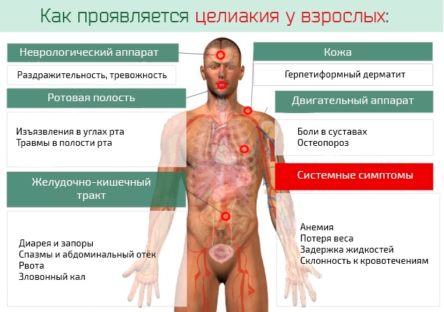 Болезни кишечника у мужчин. Симптомы, признаки