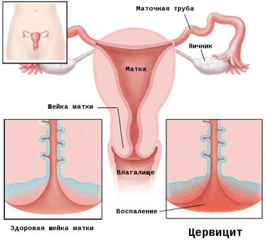 Гинекологическое УЗИ: виды, как называется ультразвуковое исследование внутренних органов