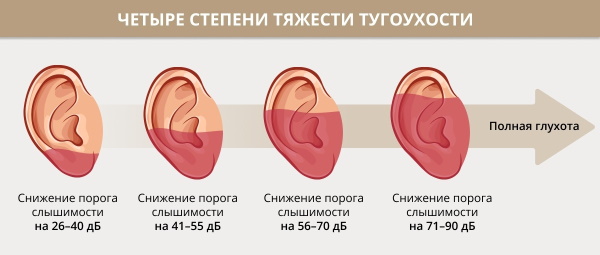 Гнойный отит у ребенка. Симптомы, лечение, капли