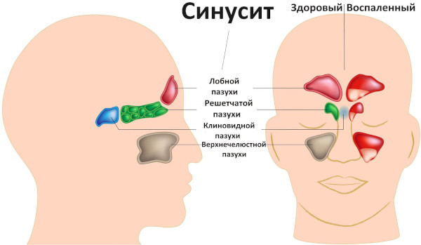 Турунда что это, как сделать