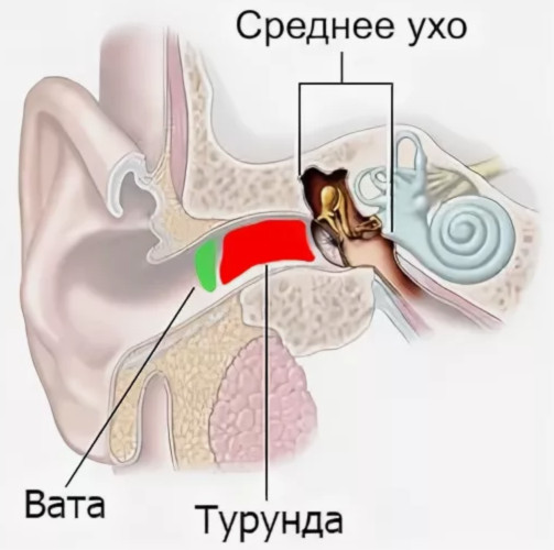 Турунда что это, как сделать