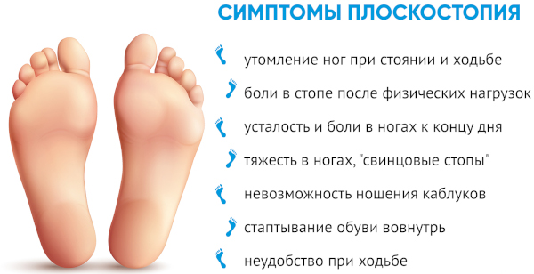 Упражнения для стоп при плоскостопии, вальгусной деформации