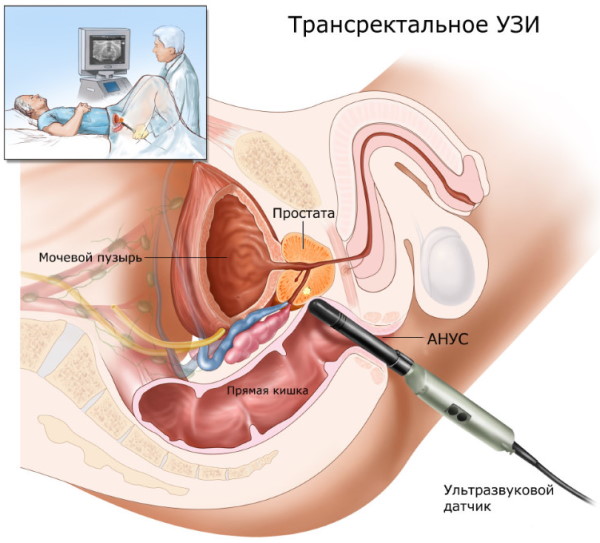 Гинекологическое УЗИ: виды, как называется ультразвуковое исследование внутренних органов