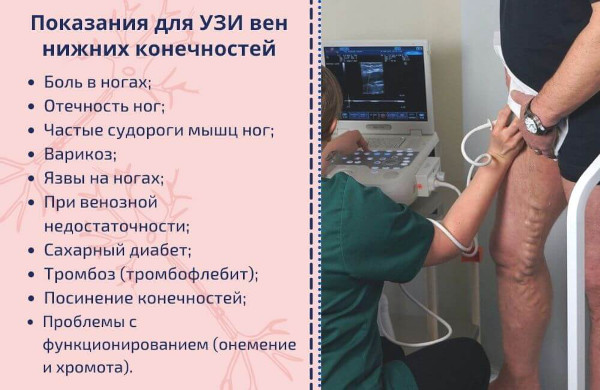 УЗИ сосудов ног. Что показывает, как делают