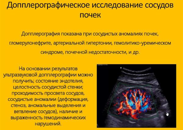 УЗИ сосудов почек. Для чего, как делают, подготовка
