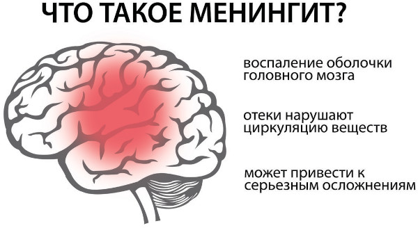Менингит у детей 5-10 лет. Симптомы, как проявляется