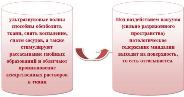 Вакуумное промывание миндалин. Что это такое, цена, отзывы