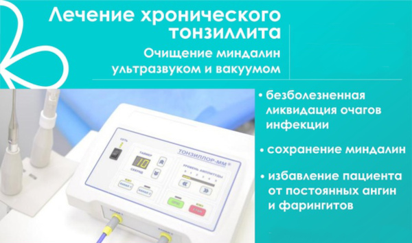 Вакуумное промывание миндалин. Что это такое, цена, отзывы