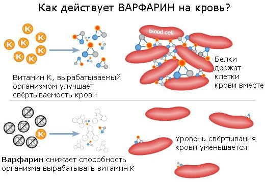 Диета при приеме Варфарина. Список запрещенных продуктов при аритмии, после операции