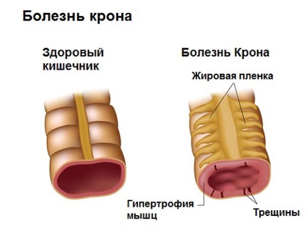 Пассаж бария по тонкому кишечнику: рентген, описание, подготовка