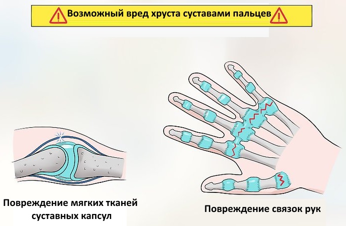 Вредно ли хрустеть пальцами на руках. Научное объяснение