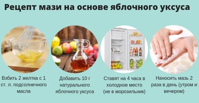 Яблочный уксус при подагре. Можно ли, рецепты, отзывы