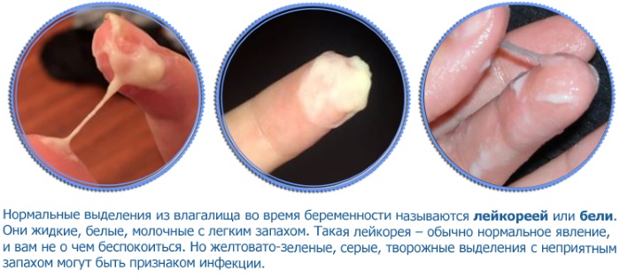 Желтая слизь из влагалища. Что это такое, причины перед и после кесарева, месячных, овуляции, родов, что делать