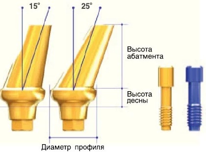 Абатменты для имплантов. Что это такое, где купить, виды, цена
