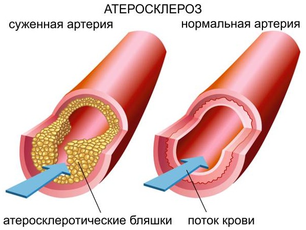 Как принимать Аевит взрослым в капсулах. Инструкция для профилактики, кожи лица, волос, ногтей, глаз