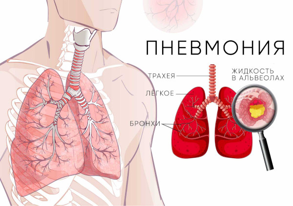 Амоксиклав или Азитромицин. Что лучше, эффективнее, разница