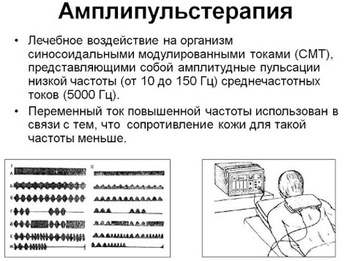 Амплипульс. Что это за процедура для детей, беременных, похудения. Отзывы