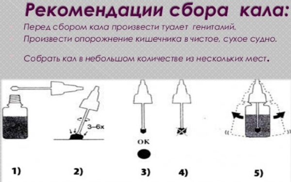 Анализы на кишечную инфекцию, стафилококк, брюшной тиф. Какие, как сдавать у ребенка, как называется, что это такое, как берут, цена