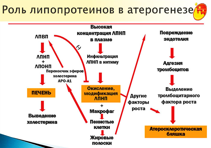 Атеросклероз сосудов сердца. Симптомы и лечение у пожилых людей, причины