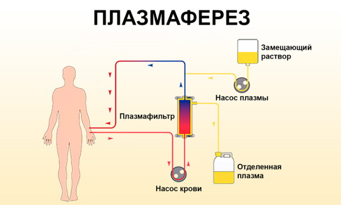Болезнь Бехчета. Что это, симптомы, лечение