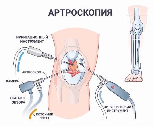 Болезнь Бехчета. Что это, симптомы, лечение